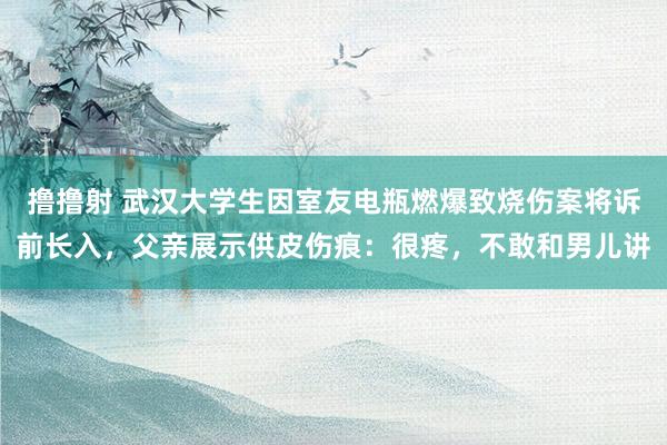 撸撸射 武汉大学生因室友电瓶燃爆致烧伤案将诉前长入，父亲展示供皮伤痕：很疼，不敢和男儿讲